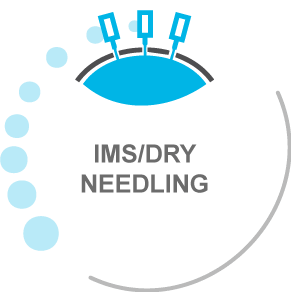 IMS / Dry Needling